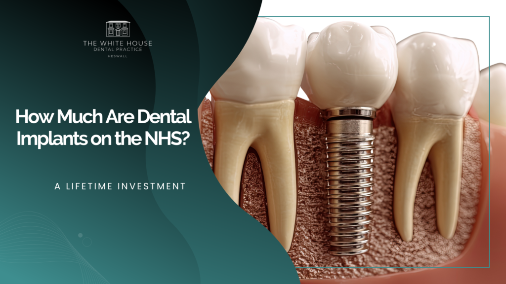 How Much Are Dental Implants on the NHS?