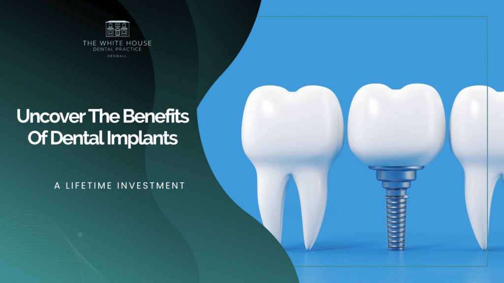 Uncover The Benefits Of Dental Implants: A Lifetime Investment